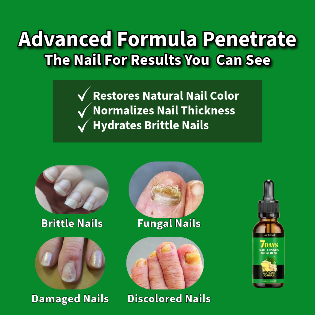 Nail Elixir™ Ginger & 7 Oil Formula